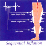 Acute Hemodynamic Effects