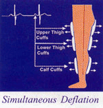 Acute Hemodynamic Effects